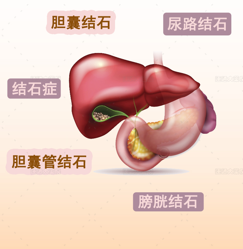 乐事华沙利石素60s_04.jpg